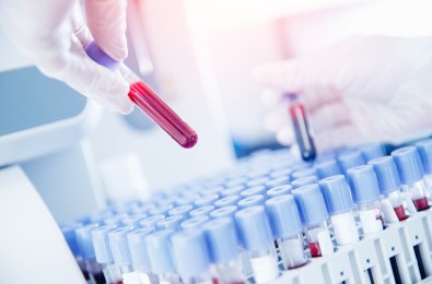 Serologiniai infekcijų tyrimai -  ką reikia žinoti?
